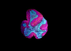 Medium Brain Coral - Lobophyllia or Symphyllia - Assorted